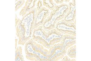 Immunohistochemistry analysis of paraffin-embedded rat small intestine using GBA (ABIN7074062) at dilution of 1: 2000 (GBA anticorps)