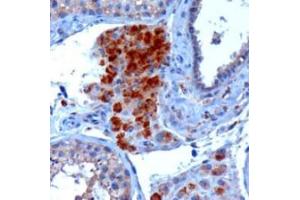 Image no. 1 for anti-SECIS Binding Protein 2 (SECISBP2) (Internal Region) antibody (ABIN374739) (SECISBP2 anticorps  (Internal Region))