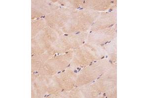(ABIN6242630 and ABIN6577239) staining SD1 in hun skeletal muscle tissue sections by Immunohistochemistry (IHC-P - paraforldehyde-fixed, paraffin-embedded sections).