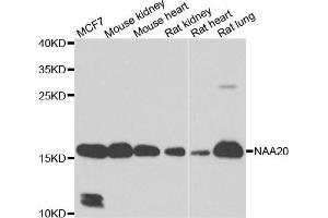 Western blot analysis of extracts of various cell lines, using NAA20 antibody. (NAT5 anticorps)