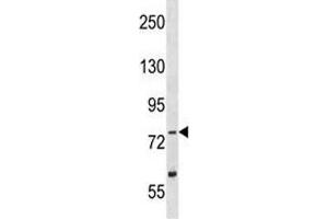 TLK2 antibody western blot analysis in Y79 lysate (TLK2 anticorps  (AA 141-171))