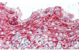 Detection of SPINK5 in Human Tonsil Tissue using Polyclonal Antibody to Serine Peptidase Inhibitor Kazal Type 5 (SPINK5)