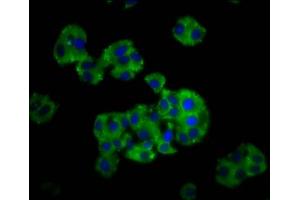 Immunofluorescence staining of HepG2 cells with ABIN7149218 at 1:166, counter-stained with DAPI. (CYP26C1 anticorps  (AA 331-460))