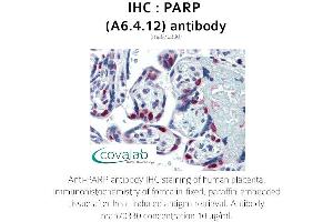 Image no. 1 for anti-Poly (ADP-Ribose) Polymerase 1 (PARP1) antibody (ABIN1723251)