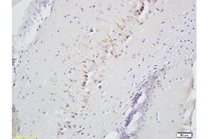 Formalin-fixed and paraffin embedded rat brain labeled with Anti-Slit2/Slil3 Polyclonal Antibody, Unconjugated (ABIN749963) at 1:300 followed by conjugation to the secondary antibody and DAB staining (SLIT2 anticorps  (AA 451-550))