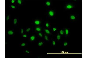 anti-Vav 1 Oncogene (VAV1) (AA 681-790) antibody