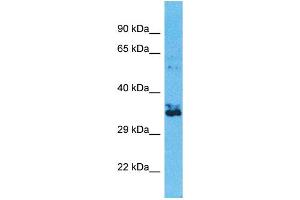Western Blotting (WB) image for anti-Olfactory Receptor, Family 2, Subfamily W, Member 1-Like (OR2W3) (C-Term) antibody (ABIN2791730) (OR2W3 anticorps  (C-Term))