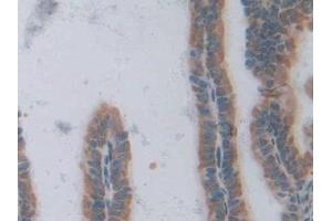 Detection of TCF20 in Mouse Ovary Tissue using Polyclonal Antibody to Transcription factor 20 (TCF20)