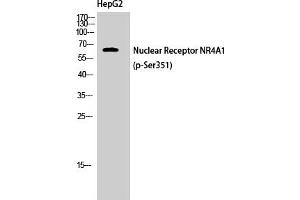 Western Blotting (WB) image for anti-Nuclear Receptor Subfamily 4, Group A, Member 1 (NR4A1) (pSer351) antibody (ABIN5961749)