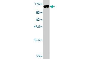 Western Blot detection against Immunogen (93.