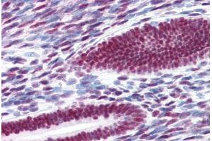 Human Uterus (formalin-fixed, paraffin-embedded) stained with ESR1 antibody ABIN337383 at 10 ug/ml followed by biotinylated goat anti-rabbit IgG secondary antibody ABIN481713, alkaline phosphatase-streptavidin and chromogen. (Estrogen Receptor alpha anticorps  (C-Term))