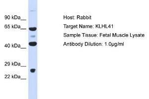 Host: Rabbit Target Name: KLHL41 Sample Type: Fetal Muscle lysates Antibody Dilution: 1.