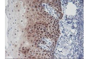 Image no. 5 for anti-Interferon Regulatory Factor 6 (IRF6) antibody (ABIN1498901)