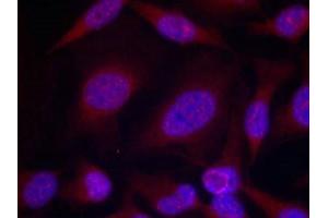Immunofluorescence staining of methanol-fixed Hela cells using JNK1/JNK2/JNK3(phospho-Thr183/Tyr185) Antibody. (JNK anticorps  (pThr183, pTyr185))