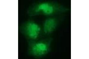 Anti-SPR mouse monoclonal antibody (ABIN2453681) immunofluorescent staining of COS7 cells transiently transfected by pCMV6-ENTRY SPR (RC205679). (SPR anticorps)