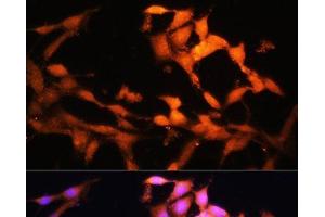 Immunofluorescence analysis of NIH/3T3 cells using FLCN Polyclonal Antibody at dilution of 1:100.