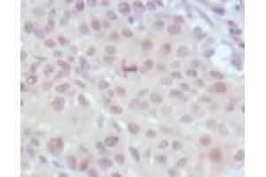 Immunohistochemistry (IHC) image for anti-Myeloid/lymphoid Or Mixed-Lineage Leukemia (MLL) (AA 3751-3968) antibody (ABIN2464083) (MLL/KMT2A anticorps  (AA 3751-3968))