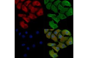 Phospho-IFNAR1 (Tyr466) Antibody staining Hela cells(heat shock treatment) by IF/ICC.