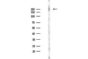 Western blot analysis of lysates from K562 cells(starvation 24h treatment), using Lrp2 / Megalin Antibody at 1/1000 dilution.