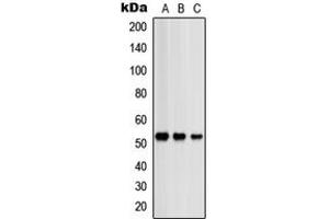 Western blot analysis of PRKAR2B expression in HeLa (A), SHSY5Y (B), NIH3T3 (C) whole cell lysates.