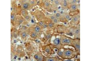 Used in DAB staining on fromalin fixed paraffin-embedded Liver tissue