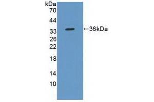 Detection of Recombinant ROS1, Human using Polyclonal Antibody to C-Ros Oncogene 1, Receptor Tyrosine Kinase (ROS1) (ROS1 anticorps  (AA 1945-2222))
