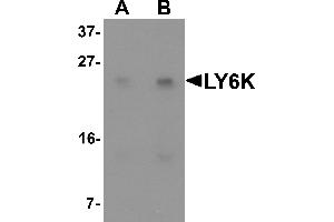 Western blot analysis of LY6K in HeLa cell lysate with LY6K antibody at (A) 1 and (B) 2 µg/mL. (Ly6k anticorps  (N-Term))