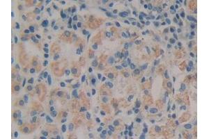 Detection of VLDLR in Human Stomach Tissue using Polyclonal Antibody to Very Low Density Lipoprotein Receptor (VLDLR)