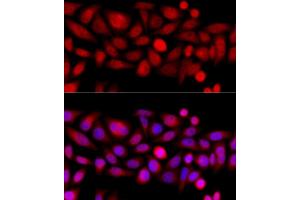 Immunofluorescence analysis of HeLa cells using KIF4A antibody (ABIN6128156, ABIN6142873, ABIN6142874 and ABIN6214349) at dilution of 1:100 (40x lens).