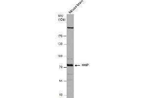 WB Image HHIP antibody [N3C2], Internal detects HHIP protein by western blot analysis. (HHIP anticorps)