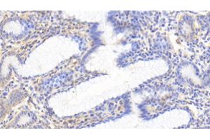 Detection of Hsp60 in Human Stomach Tissue using Polyclonal Antibody to Heat Shock Protein 60 (Hsp60)