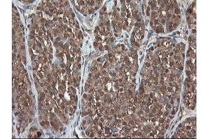 Image no. 3 for anti-Pyridoxamine 5'-Phosphate Oxidase (PNPO) antibody (ABIN1500318)