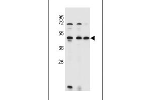 ANKRD40 Antibody (C-term) (ABIN655309 and ABIN2844891) western blot analysis in 293,HL-60,MCF-7 cell line lysates (35 μg/lane).