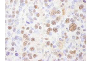 Immunohistochemistry (IHC) image for anti-Proteasome (Prosome, Macropain) 26S Subunit, ATPase, 1 (PSMC1) (AA 390-440) antibody (ABIN7454963)