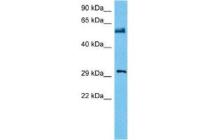 Host:  Mouse  Target Name:  NFIA  Sample Tissue:  Mouse Testis  Antibody Dilution:  1ug/ml (NFIA anticorps  (Middle Region))