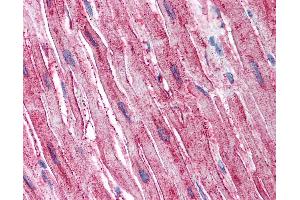 Anti-ADAMTS4 antibody IHC of human heart.