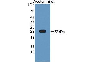 Figure. (CTAG1B anticorps  (AA 1-180))