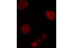 ABIN6274502 staining Hela cells by IF/ICC. (PBOV1 anticorps  (Internal Region))