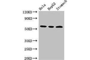 Western Blot Positive WB detected in: Hela whole cell lysate, HepG2 whole cell lysate, Mouse stomach tissue All lanes: MDM4 antibody at 3 μg/mL Secondary Goat polyclonal to rabbit IgG at 1/50000 dilution Predicted band size: 55, 15, 14, 19, 50 kDa Observed band size: 55 kDa (MDM4-binding Protein anticorps  (AA 208-306))