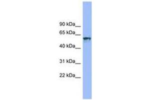 Image no. 1 for anti-Interleukin 18 Receptor 1 (IL18R1) (AA 35-84) antibody (ABIN6743248) (IL18R1 anticorps  (AA 35-84))