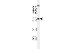 BMP4 antibody western blot analysis in MDA-MB435 lysate. (BMP4 anticorps  (AA 5-34))
