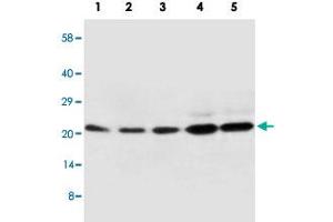 Western blot analysis of tissue and whole cell extracts with CDC42 polyclonal antibody . (CDC42 anticorps  (Internal Region))