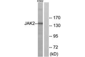 Western blot analysis of extracts from K562 cells, using JAK2 (Ab-221) Antibody. (JAK2 anticorps  (AA 191-240))