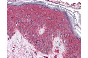 Anti-KLHL23 antibody IHC of human skin. (KLHL23 anticorps  (AA 432-481))