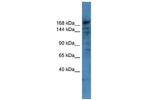 WB Suggested Anti-COL4A6 Antibody Titration: 0. (COL4a6 anticorps  (Middle Region))