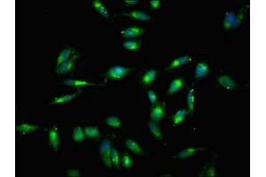Immunofluorescent analysis of Hela cells using ABIN7172594 at dilution of 1:100 and Alexa Fluor 488-congugated AffiniPure Goat Anti-Rabbit IgG(H+L)