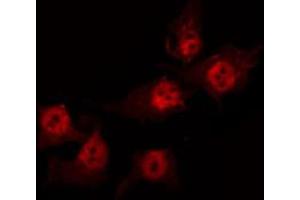 ABIN6274101 staining HuvEc by IF/ICC. (ANP32C anticorps  (Internal Region))