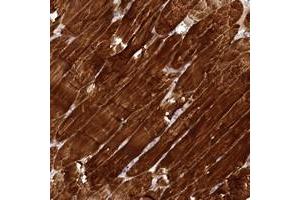 Immunohistochemical staining of human skeletal muscle with SYNPO2 polyclonal antibody  shows strong cytoplasmic positivity in myocytes at 1:500-1:1000 dilution.