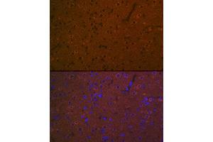 Immunofluorescence analysis of rat brain using 5HT7 Receptor Rabbit mAb (ABIN7265341) at dilution of 1:100 (40x lens). (HTR7 anticorps)