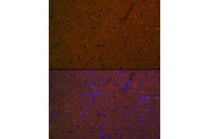 Immunofluorescence analysis of rat brain using 5HT7 Receptor Rabbit mAb (ABIN7265341) at dilution of 1:100 (40x lens). (HTR7 anticorps)